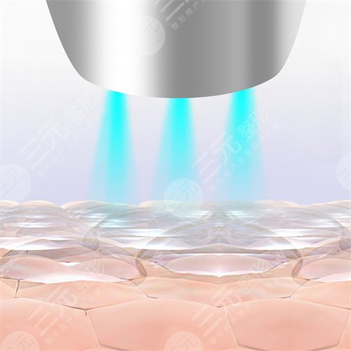 熱瑪吉相關問答科普