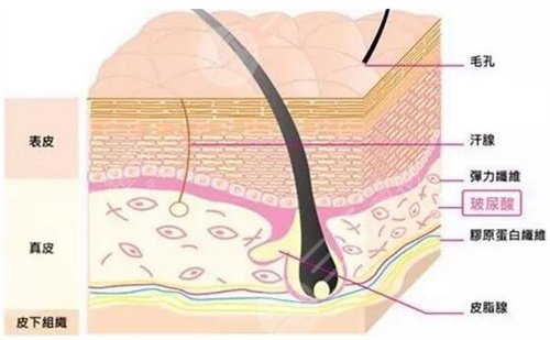 注射填充去皺案例