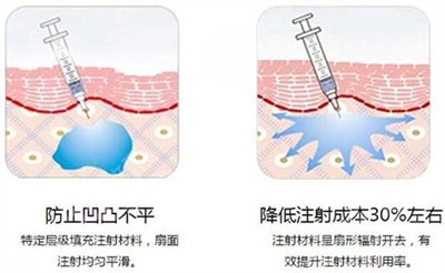 打玻尿酸有什么作用