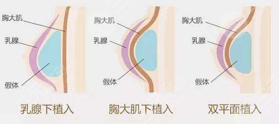 娜綺麗和傲諾拉哪款好？