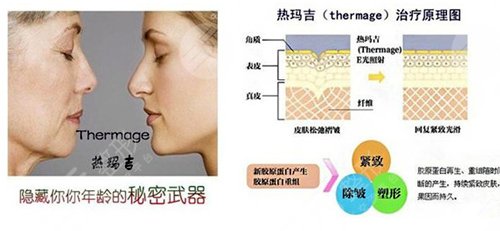 熱瑪吉做一次多少錢？有3個影響價格的因素！附注意事項~