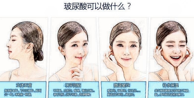 玻尿酸填充全臉好不好？術(shù)后要注意什么？超全科普來襲~