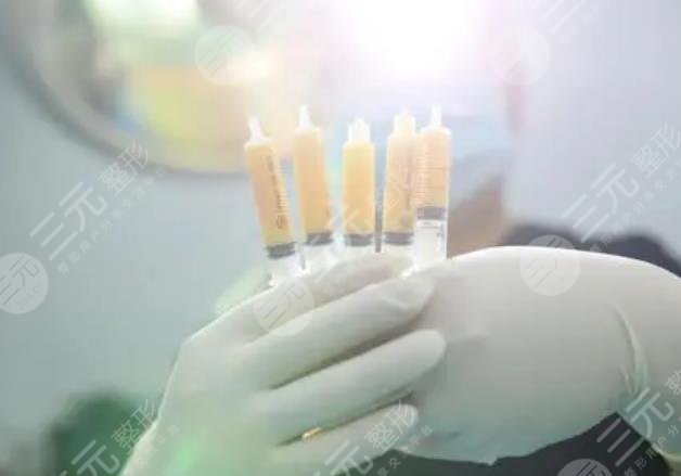 自體脂肪隆胸需要多少錢?