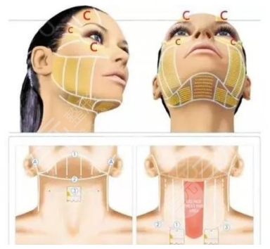 熱瑪吉多少錢？有什么果和副作用？原理以及優(yōu)勢盤點！抗衰必看~