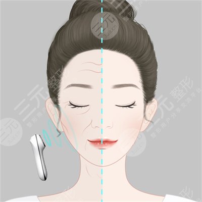 熱拉提原理和作用