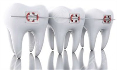 洛陽牙大夫矯正牙齒案例