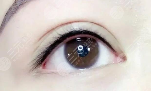 美瞳線一到七天恢復(fù)過(guò)程圖