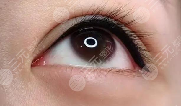 美瞳線一到七天恢復(fù)過(guò)程圖