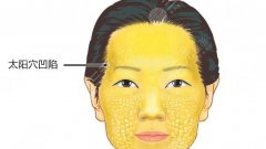 自體脂肪填充太陽凹陷是*的嗎？果&優(yōu)點科普，值得pick！