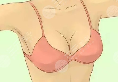 傲若拉璀璨隆胸怎么樣？假體隆胸術(shù)前準(zhǔn)備及術(shù)后護(hù)理事項(xiàng)get
