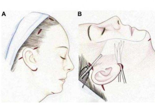北京八大處楊欣擅長項目：