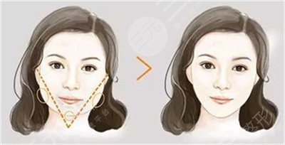 快樂女聲江映蓉照片對比