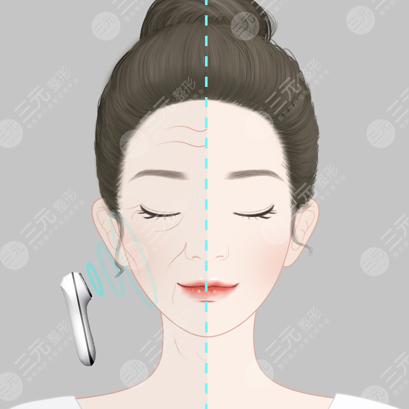 面部松弛怎么辦，做面b提升怎樣