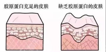 膠原蛋白豐唇降低風(fēng)險(xiǎn)嗎？術(shù)前我們要了解這些哦~