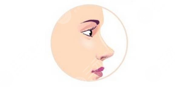 微創(chuàng)隆鼻的價(jià)格大概多少呢？微創(chuàng)隆鼻的價(jià)格貴嗎？