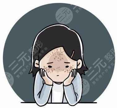 像素激光祛痘印成好嗎？大概能維持多久呢？