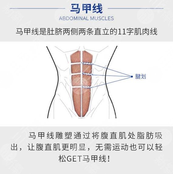 馬甲線吸脂怎么做，有果嗎？科普&術(shù)后事項(xiàng)分享，塑形正當(dāng)時(shí)！