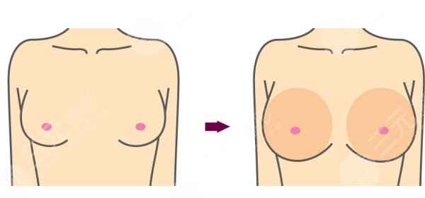 楊慶華醫(yī)生擅長(zhǎng)項(xiàng)目：