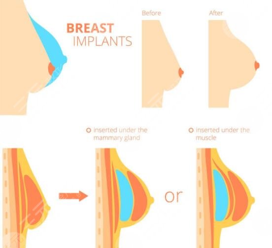德國(guó)寶儷與美國(guó)曼托哪一個(gè)好？