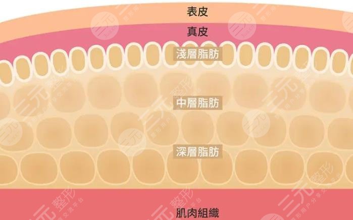 超脂塑體雕術(shù)