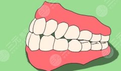 假牙的種類及價(jià)格詳細(xì)介紹！種牙or活動假牙？分享牙齒修復(fù)建議~