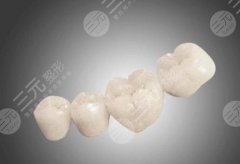 假牙和種植牙哪個(gè)好？科普，4點(diǎn)區(qū)別解答幫你搞明白！