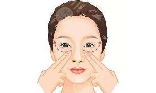 自體脂肪填充太陽穴有什么優(yōu)勢呢?