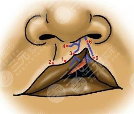 兔唇手術(shù)大概需要花費(fèi)多少元？緩解兔唇大約的費(fèi)用是多少錢？?jī)r(jià)格表