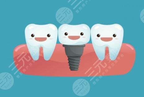 昆明德韓口腔醫(yī)院口腔種植牙經(jīng)歷分享