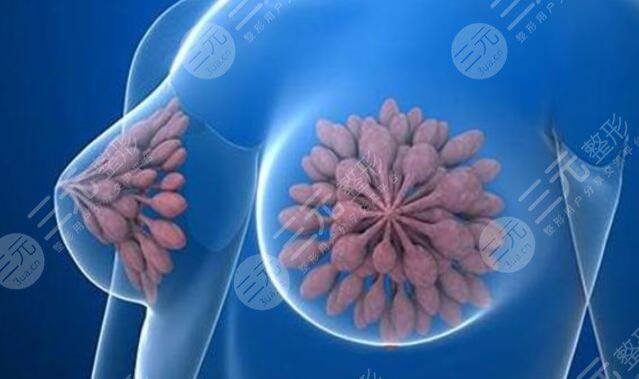 棒棒糖縮胸手術疤痕多久可以恢復？手術優(yōu)缺點+多少天完全消腫？