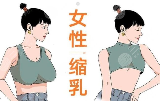 棒棒糖縮胸手術多少天完全消腫？