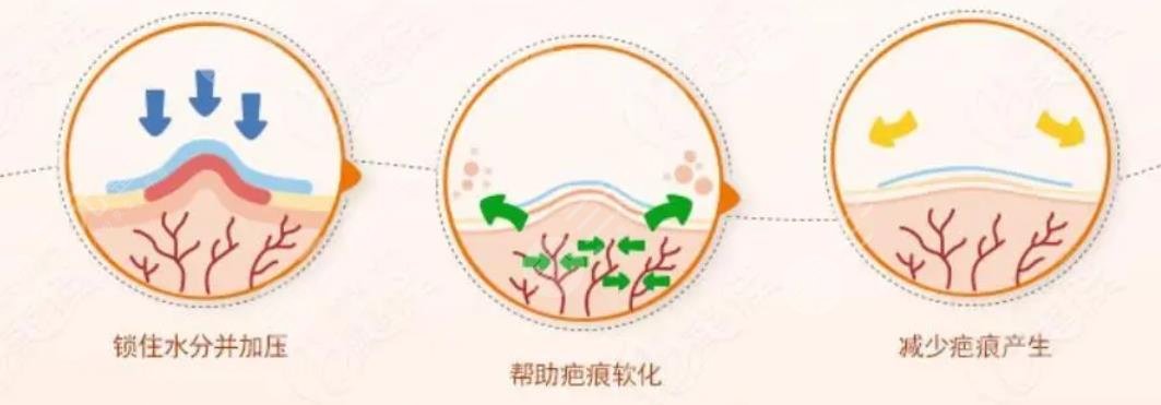 深圳激光去疤痕有嗎?