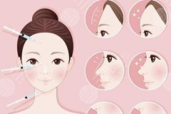 自體脂肪填充面部能保持多長時間？超全資料科普，優(yōu)點&注意事項get！