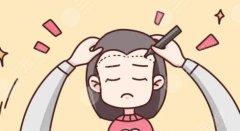 植發(fā)際線費(fèi)用多少錢？新價(jià)格表參考&注意事項(xiàng)分享，超全術(shù)前指南！