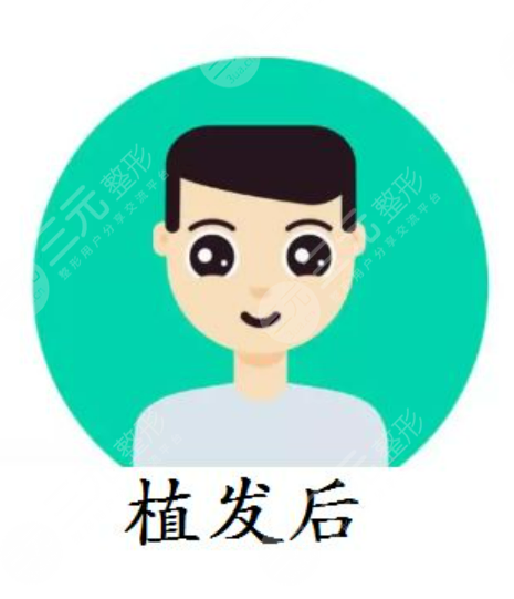 重慶新生植發(fā)醫(yī)院術(shù)后體驗評價