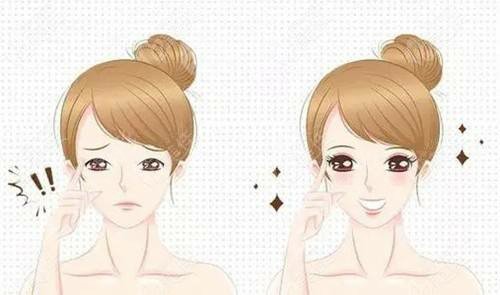 浙醫(yī)一院割雙眼皮要預(yù)約嗎?