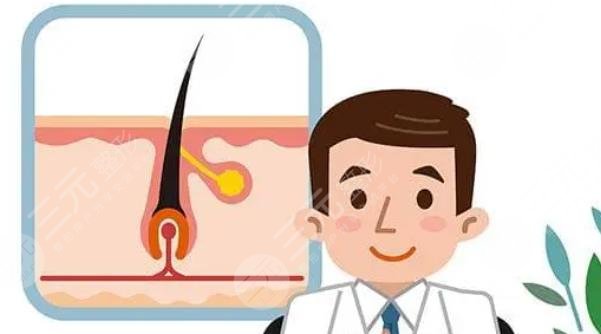 頭頂加密一般需要多少單位？科普解答&術(shù)后護(hù)理知識(shí)，助你告別地中海！