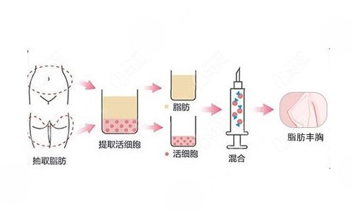 成都西區(qū)醫(yī)院整形科熱門項目科普