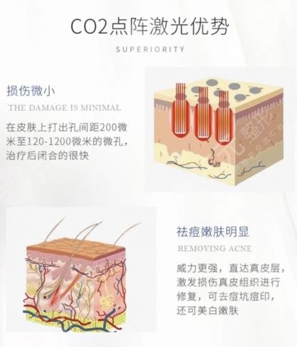 深圳市第二人民醫(yī)院點陣激光手術(shù)果