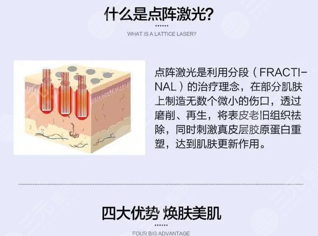 深圳市第二人民醫(yī)院點陣激光手術(shù)果