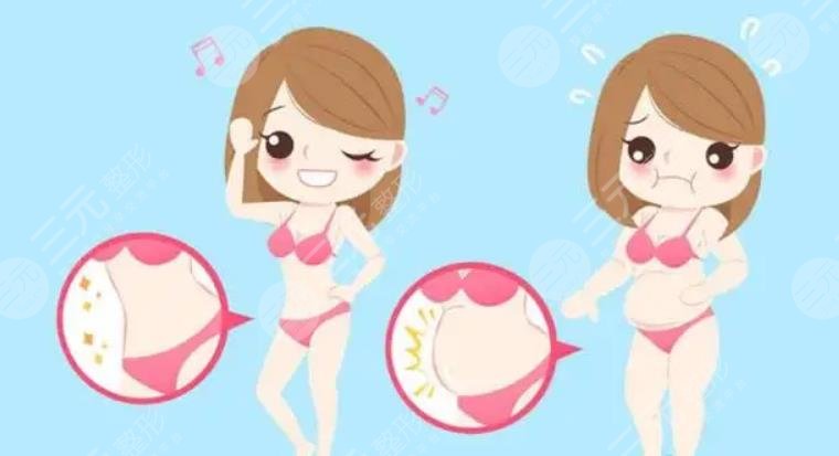 腰腹吸脂后1 到7天圖片