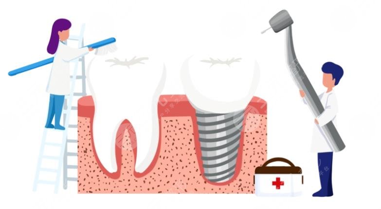 牙齒種植體十大排名NO.3、登士伯希諾德種植體