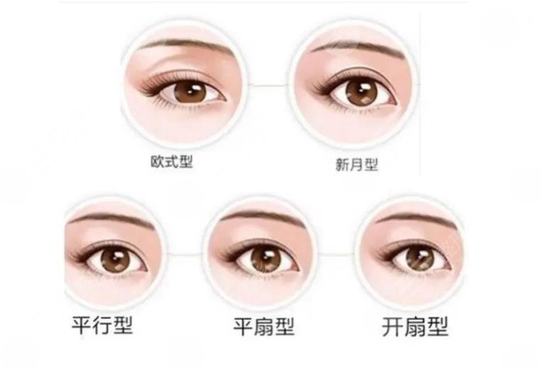 割雙眼皮十個(gè)有九個(gè)后悔真的嗎？3點(diǎn)術(shù)前了解事宜盤點(diǎn)！