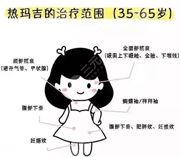 北京熱瑪吉個人真實感受