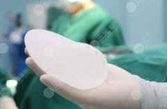 法芮婭OM25萬貴嗎？德國top級隆胸假體，凝聚精湛技藝與美學(xué)！