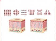 杭州全臉點陣激光一次多少錢？分享價格及美膚注意事項，小白必備！