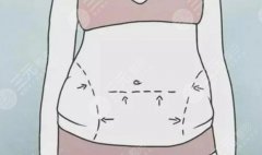 吸脂體雕的作用與好處是什么？科普了解塑形的魅力！夏日必備！