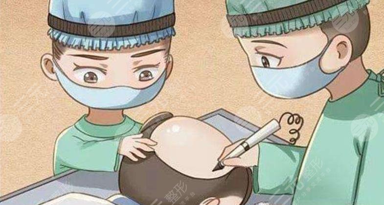 植發(fā)3000個(gè)單位的價(jià)格是多少