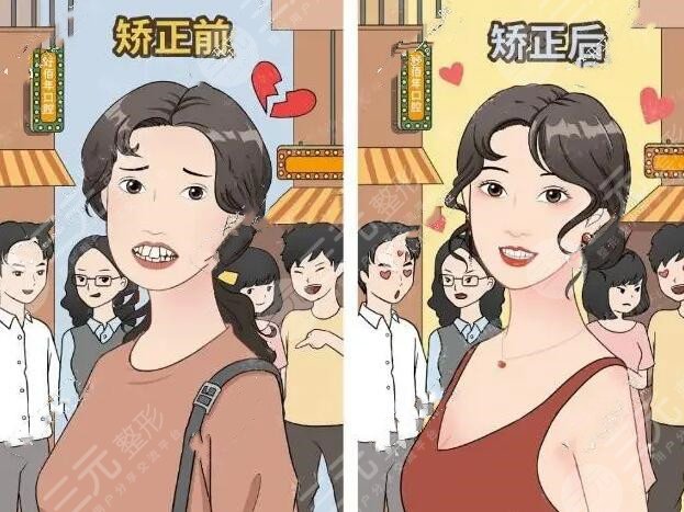 瀘州口腔醫(yī)院牙齒矯正案例