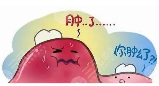 牙齦腫痛吃什么藥快速消腫止痛？是什么原因引起的？牙齦小知識(shí)科普！